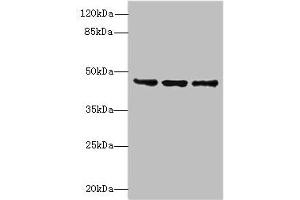 Western blot All lanes: FAM53B antibody at 2 μg/mL Lane 1: MCF-7 whole cell lysate Lane 2: A549 whole cell lysate Lane 3: HCT116 whole cell lysate Secondary Goat polyclonal to rabbit IgG at 1/10000 dilution Predicted band size: 46, 34 kDa Observed band size: 46 kDa (FAM53B 抗体  (AA 1-305))