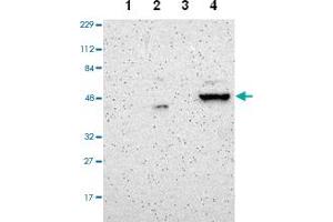 Western blot analysis of Lane 1: Human cell line RT-4, Lane 2: Human cell line U-251MG sp, Lane 3: Human plasma (IgG/HSA depleted), Lane 4: Human liver tissue with ZNF670 polyclonal antibody  at 1:100-1:250 dilution. (ZNF670 抗体)