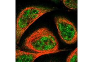 Immunofluorescent staining of human cell line A-431 with TERF2 polyclonal antibody  under 1-4 ug/mL working concentration shows positivity in cytoplasm & nucleus but excluded from the nucleoli. (TRF2 抗体)