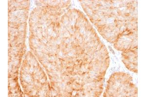 Immunohistochemistry (IHC) image for anti-Solute Carrier Family 2 (Facilitated Glucose Transporter), Member 1 (SLC2A1) (AA 203-305) antibody (ABIN6940594)