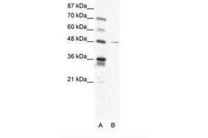 Image no. 1 for anti-Nuclear Factor I/C (CCAAT-Binding Transcription Factor) (NFIC) (AA 184-233) antibody (ABIN202501) (NFIC 抗体  (AA 184-233))