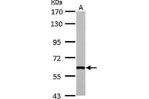 WB Image FAST antibody detects FASTK protein by Western blot analysis. (FASTK 抗体  (C-Term))