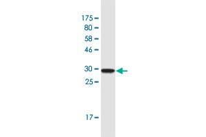 Western Blot detection against Immunogen (32. (CLTA 抗体  (AA 118-176))