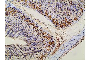Immunohistochemistry (IHC) image for anti-Phosphoinositide 3 Kinase, p85 alpha (PI3K p85a) (pTyr607) antibody (ABIN6256775)
