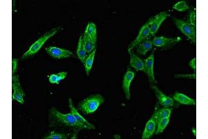 Immunofluorescent analysis of Hela cells using ABIN7168622 at dilution of 1:100 and Alexa Fluor 488-congugated AffiniPure Goat Anti-Rabbit IgG(H+L) (SLFN11 抗体  (AA 670-821))