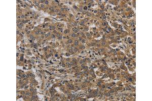 Immunohistochemistry of Human brain  using KIF4A Polyclonal Antibody at dilution of 1:40 (KIF4A 抗体)