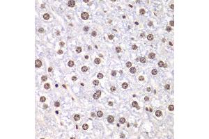 Immunohistochemistry of paraffin-embedded mouse liver using TOP1 antibody at dilution of 1:100 (400x lens). (Topoisomerase I 抗体)