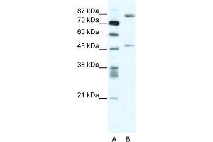WB Suggested Anti-MMAntibody Titration:  2. (MMP10 抗体  (N-Term))