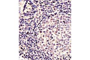 (ABIN391430 and ABIN2841422) staining EN1 in Human tonsil tissue sections by Immunohistochemistry (IHC-P - paraformaldehyde-fixed, paraffin-embedded sections). (EN1 抗体  (N-Term))