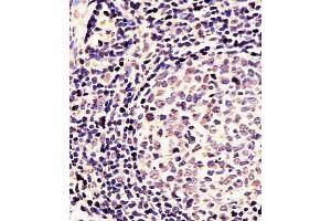 (ABIN391430 and ABIN2841422) staining EN1 in Human tonsil tissue sections by Immunohistochemistry (IHC-P - paraformaldehyde-fixed, paraffin-embedded sections). (EN1 抗体  (N-Term))