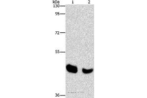 Western blot analysis of Human normal liver and mouse pancreas tissue, using BAAT Polyclonal Antibody at dilution of 1:650