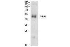 Western Blotting (WB) image for anti-Vasoactive Intestinal Peptide Receptor 1 (VIPR1) (Internal Region) antibody (ABIN6287317)