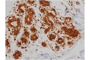 ABIN6267336 at 1/200 staining Human heart tissue sections by IHC-P. (IGF1R 抗体  (pTyr1346))
