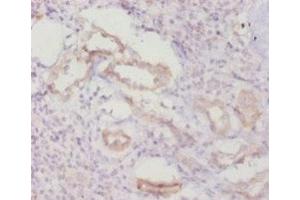Immunohistochemistry of paraffin-embedded human kidney tissue using ABIN7146964 at dilution of 1:20 (Caspase 8 抗体  (AA 217-374))
