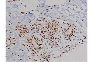 Immunohistochemistry (IHC) image for anti-zeta-Chain (TCR) Associated Protein Kinase 70kDa (ZAP70) (pTyr319) antibody (ABIN6255884)