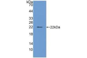 Detection of Recombinant FTL, Bovine using Polyclonal Antibody to Ferritin, Light Polypeptide (FTL) (FTL 抗体  (AA 1-175))