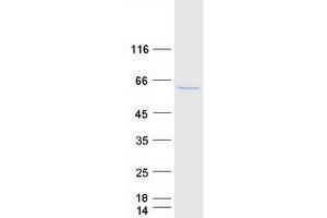 Validation with Western Blot