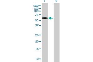 Western Blot analysis of MAP3K7IP1 expression in transfected 293T cell line by MAP3K7IP1 MaxPab polyclonal antibody.