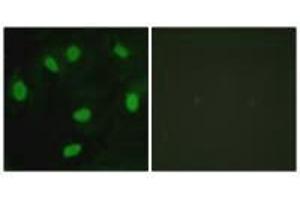 Immunofluorescence analysis of HeLa cells, using TBX15/18 antibody. (T-Box 15 抗体)
