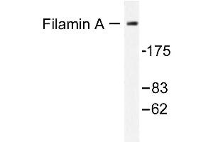 Image no. 1 for anti-Filamin A, alpha (FLNA) antibody (ABIN265421) (Filamin A 抗体)