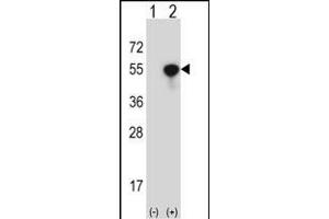 Western blot analysis of NCK1 (arrow) using rabbit polyclonal NCK1 Antibody (N-term) (ABIN657648 and ABIN2846643). (NCK1 抗体  (N-Term))