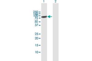 Western Blot analysis of CHEK2 expression in transfected 293T cell line by CHEK2 MaxPab polyclonal antibody. (CHEK2 抗体  (AA 1-543))