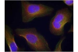 Image no. 3 for anti-Protein Kinase C, theta (PRKCQ) (pSer676) antibody (ABIN197070) (PKC theta 抗体  (pSer676))