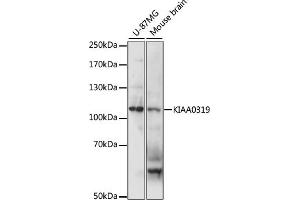 Western blot analysis of extracts of various cell lines, using KI antibody (ABIN7268112) at 1:1000 dilution. (KIAA0319 抗体  (AA 21-300))