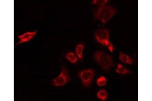 ABIN6274954 staining A549 by IF/ICC. (CHST2 抗体  (N-Term))