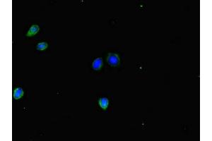 Immunofluorescent analysis of HepG2 cells using ABIN7155679 at dilution of 1:100 and Alexa Fluor 488-congugated AffiniPure Goat Anti-Rabbit IgG(H+L) (DLX5 抗体  (AA 1-249))