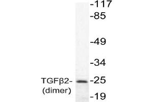 Image no. 1 for anti-Transforming Growth Factor, beta 2 (TGFB2) antibody (ABIN271850) (TGFB2 抗体)