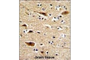 Formalin-fixed and paraffin-embedded human brain with P Antibody (N-term), which was peroxidase-conjugated to the secondary antibody, followed by DAB staining. (APP 抗体  (N-Term))