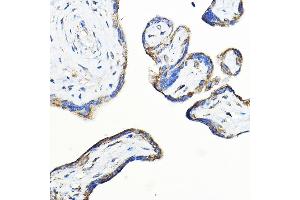 Immunohistochemistry of paraffin-embedded human placenta using LNPEP Rabbit pAb (ABIN6129286, ABIN6143284, ABIN6143285 and ABIN6215523) at dilution of 1:100 (40x lens). (LNPEP 抗体  (AA 1-110))