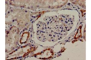 Immunocytochemistry analysis of human kidney tissue using ABIN7171654 at dilution of 1:100 (TBC1D4 抗体  (AA 1-94))