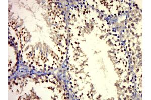 Paraformaldehyde-fixed, paraffin embedded mouse testis, Antigen retrieval by boiling in sodium citrate buffer (pH6. (Androgen Receptor 抗体  (AA 825-919))