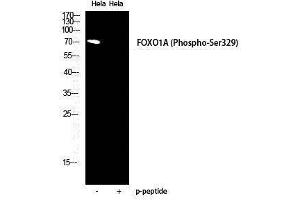 Western Blotting (WB) image for anti-Forkhead Box O1 (FOXO1) (pSer329) antibody (ABIN3173231) (FOXO1 抗体  (pSer329))