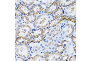 Immunohistochemistry of paraffin-embedded mouse kidney using PEX5 antibody (ABIN5973402) at dilution of 1/100 (40x lens). (PEX5 抗体)