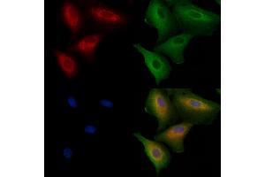 ABIN6260762 and ABIN6272273 staining Hela cells by IF/ICC.