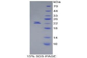 SDS-PAGE (SDS) image for Bone Morphogenetic Protein 1 (BMP1) (AA 856-982) protein (His tag) (ABIN1525361) (BMP1 Protein (AA 856-982) (His tag))