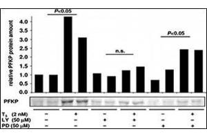 Image no. 2 for anti-phosphofructokinase, Platelet (PFKP) (C-Term) antibody (ABIN6749803) (PFKP 抗体  (C-Term))