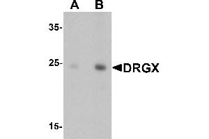 Western blot analysis of DRGX in rat liver tissue lysate with DRGX antibody at (A) 1 and (B) 2 µg/mL. (DRGX 抗体  (C-Term))