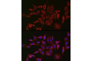 Immunofluorescence analysis of NIH/3T3 cells using GLB1 Rabbit pAb (ABIN3015642, ABIN3015643, ABIN3015644 and ABIN6218995) at dilution of 1:150 (40x lens). (GLB1 抗体  (AA 1-270))