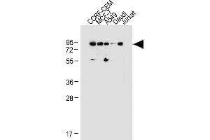 All lanes : Anti-MDM2 Antibody (C-term) at 1:1000 dilution Lane 1: CCRF-CEM whole cell lysate Lane 2: MCF-7 whole cell lysate Lane 3: A549 whole cell lysate Lane 4: Daudi whole cell lysate Lane 5: Jurkat whole cell lysate Lysates/proteins at 20 μg per lane. (MDM2 抗体  (C-Term))