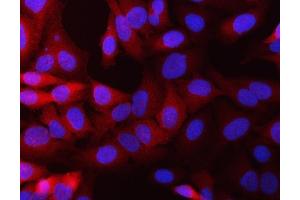 IF analysis of NQO1 using anti-NQO1 antibody (ABIN7599200).