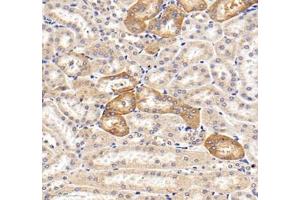 Immunohistochemistry of paraffin embedded mouse kidney using MRPS35 (ABIN7074655) at dilution of 1: 400 (300x lens)