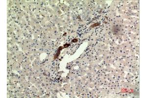 Immunohistochemistry (IHC) analysis of paraffin-embedded Human Liver, antibody was diluted at 1:100. (IFN omega (C-Term) 抗体)