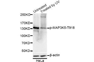 Western blot analysis of extracts of HeLa cells, using Phospho-MAP3K5-T918 antibody. (ASK1 抗体  (pThr918))