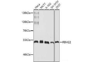 Western blot analysis of extracts of various cell lines using RBM22 Polyclonal Antibody at dilution of 1:1000. (RBM22 抗体)