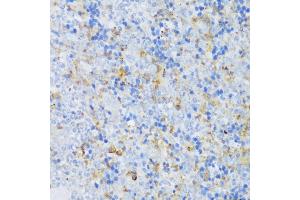 Immunohistochemistry of paraffin-embedded mouse spleen using CRA antibody (ABIN6132087, ABIN6138999, ABIN6139001 and ABIN6217973) at dilution of 1:150 (40x lens).