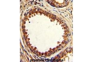 Immunohistochemistry (IHC) image for anti-Protein tyrosine Phosphatase Type IVA, Member 2 (PTP4A2) antibody (ABIN3002826)